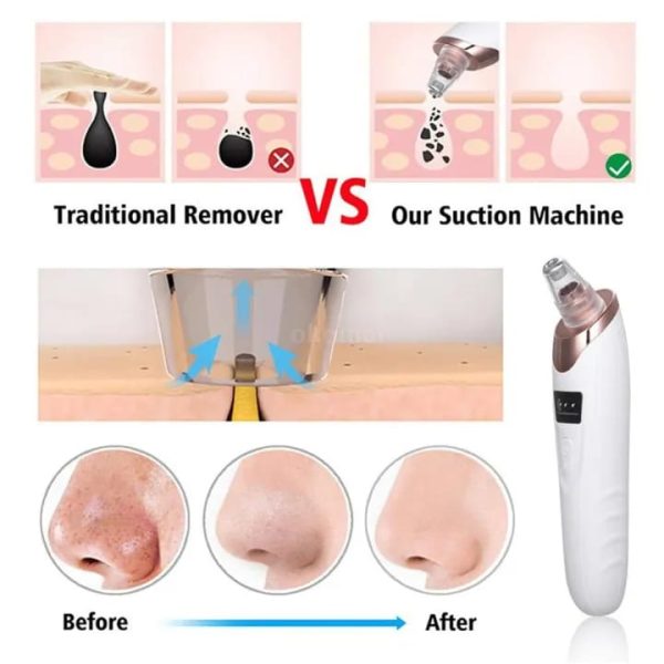Blackhead Remover Pore Cleaner